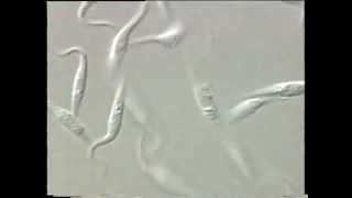 Trypanosoma