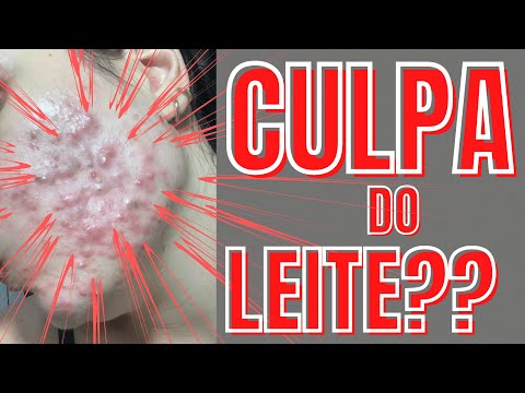 Vídeo: Glúten E Acne: Existe Uma Conexão?