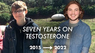 7 Years on Testosterone | FTM Transition