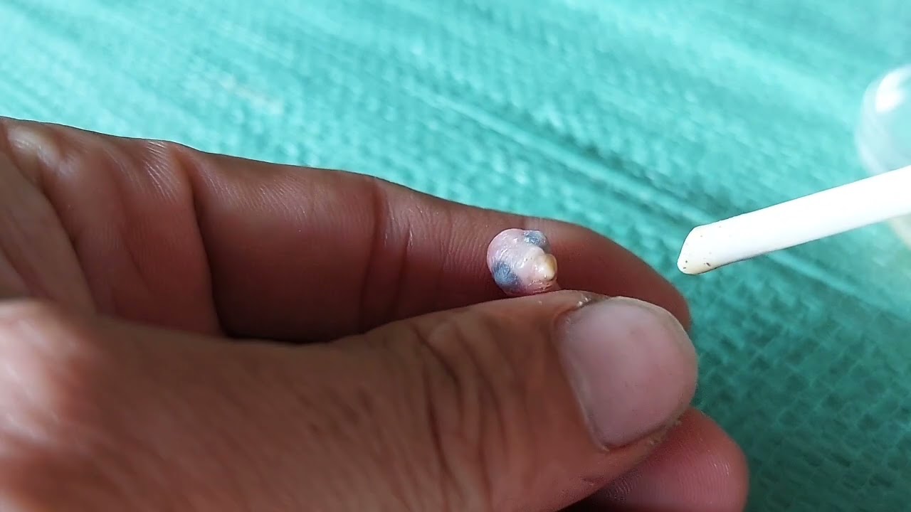 Vượt cạn cũng lắm gian lao.