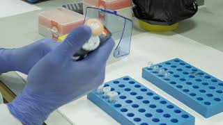 Laboratory analysis of finger prick blood test