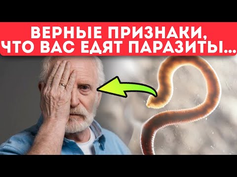 Смотри и запоминай! Вот где паразиты прячутся от чисток! Еда от глистов