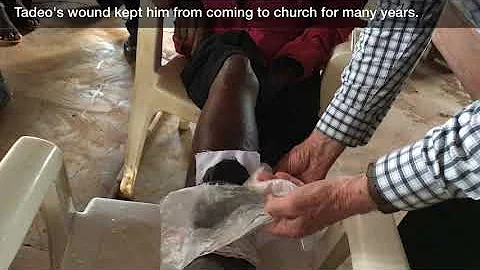 Is charcoal good for wounds?