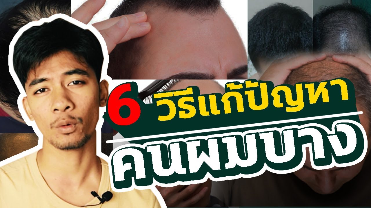 ตัดผม ทรง ไร ดี  New Update  6 วิธีแก้ปัญหาคนผมบาง (ตัดทรงไหนได้บ้าง)