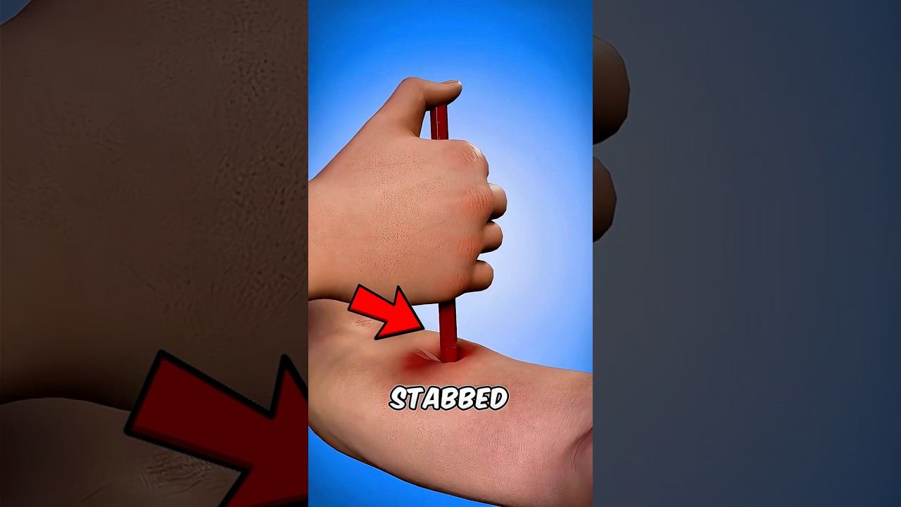 What Happens When a PENCIL Stabs Your Arm?