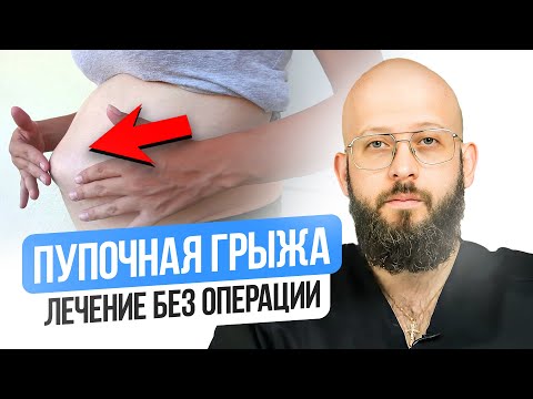 Пупочная грыжа у взрослых как лечить без операции