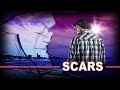 Scars  terminal sound  magic mirrors  7cis