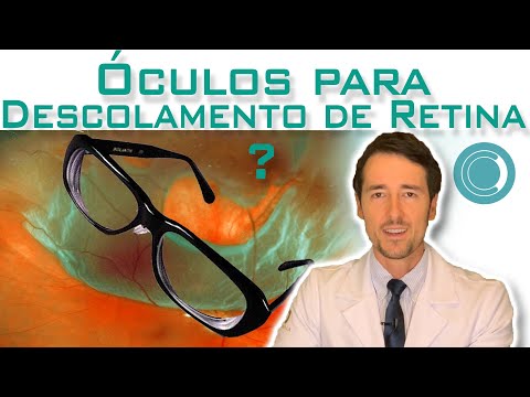 Vídeo: Os óculos ajudam após o descolamento de retina?