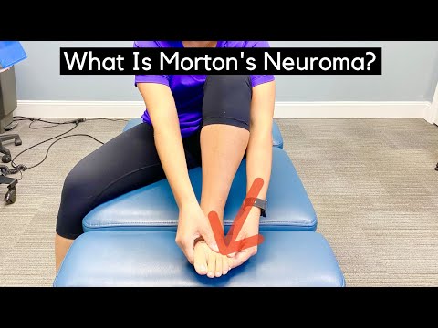 What Is Morton's