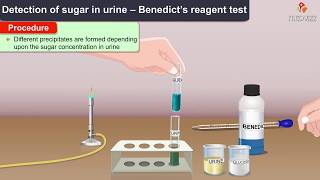 Benedict’s Test for Reducing sugars  Principle, Composition || #Usmle biochemistry