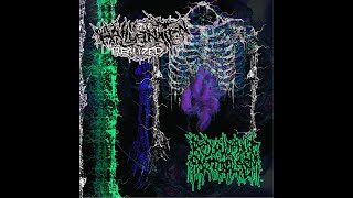 Hallucination Realized // Redundant Protoplasm - Split (2021)