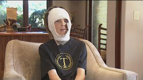 Capri Elementary: Sixth grader severely burned after black snake experiment goes wrong