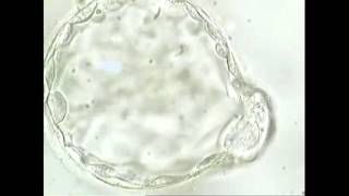 Study of Hatching Blastocyst