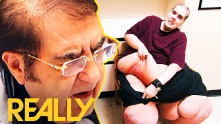 Steven Assanti Tells Dr. Now He Stinks Because Of A Rash | My 600 Lb Life: Where Are They Now? Wealth