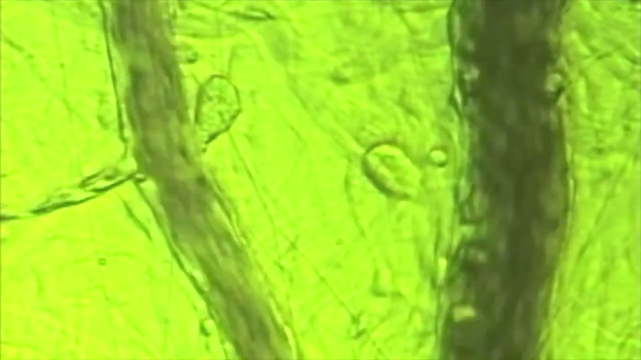 Efekt terapii mikrokrążenia BEMER