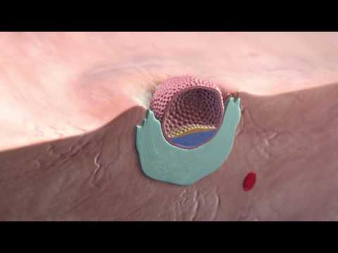 Video: Hvad udvikler blastocysthulen sig til?