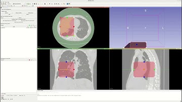 SegmentWithSAM Tutorial (3D Slicer Extension)