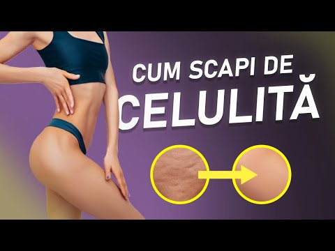 Video: Cum Să Scapi De Celulită