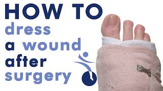 How to Wrap your Foot after Surgery 1