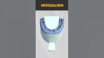 Invisalign Treatment 🦷🤓 #shorts #dentistry