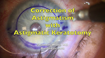 Astigmatic Keratotomy (AK). How we do it.  Shannon Wong, MD