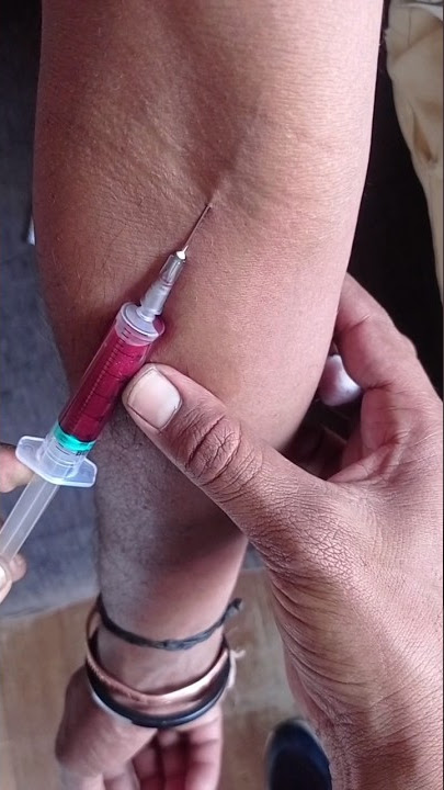 How to blood sample collection by venipuncture method #blooddonation #medico #nursing #shorts