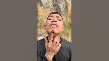 How I Cured a Bug Bite with Yogurt in the Wild | Survival Hacks