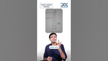 DocTutorials Daily Dose | Topic: Essex Lopresti Fracture | Dr Rohith Daniel - Orthopaedics