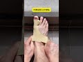 Premium Bunion Corrector Sleeve with Silicone Toe Separator for Foot Support #foot #lifeisbutadream
