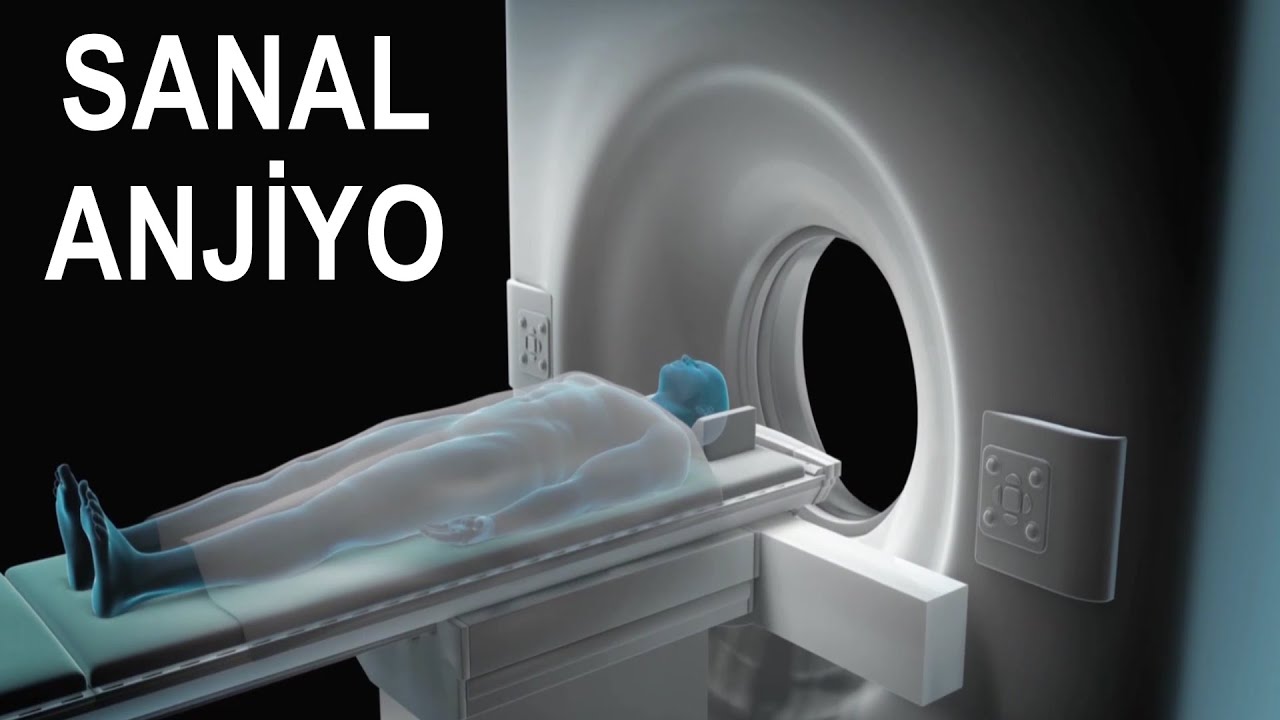 CT Angiography