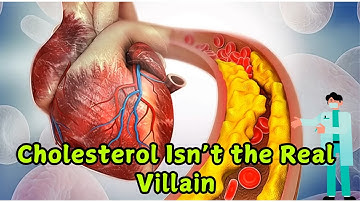 The Hidden Killer Behind Most Heart Attacks  (It’s Not Cholesterol!)
