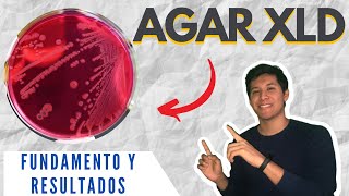 AGAR XLD FUNDAMENTO l XLD AGAR l AGAR XILOSA LISINA DESOXICOLATO l Agar XLD colonias l AGAR XLD