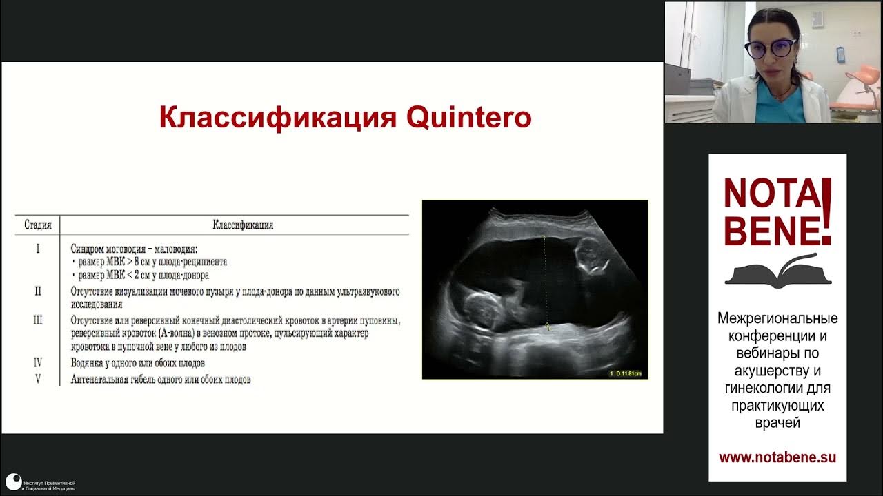 Фето-фетальный синдром при многоплодной беременности. Рекомендации по лучевой диагностике монохориальной двойни. Монохориальная диамниотическая двойня что означает. Монохориальная моноамниотическая беременность двойней форум.