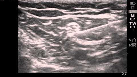 A CaseStudy Infiniti Plus Germany Wenzel Griefswald