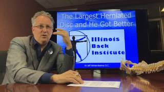 Before and After MRI Of The Largest Herniated Disc That  Was Eliminated Without Drugs Or Surgery