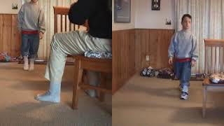 Before & After: Excess Plantarflexion - Toe Walking | DAFO 2 