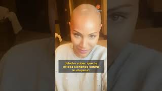Jada Pinkett Smith Yo Y Esta Alopecia Seremos Amigos