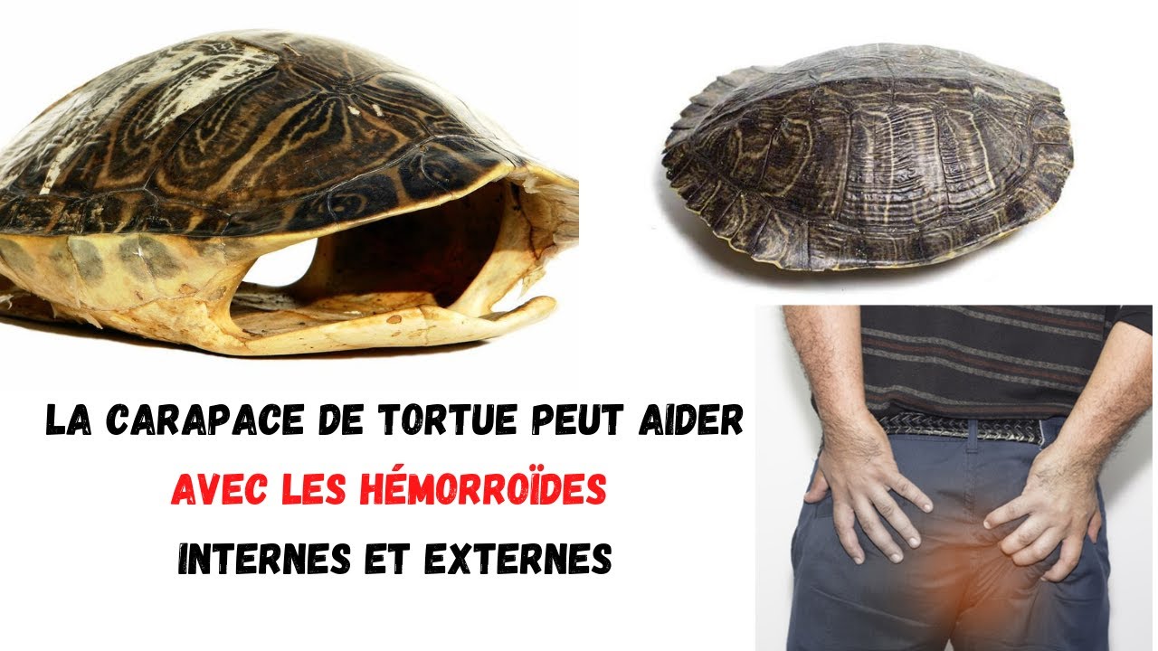 La Carapace De Tortue Peut Aider Avec Les Hemorroides Internes Et Externes Youtube
