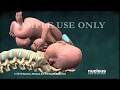 Nucleus Obstetrics and Gynecology Demo (2010)