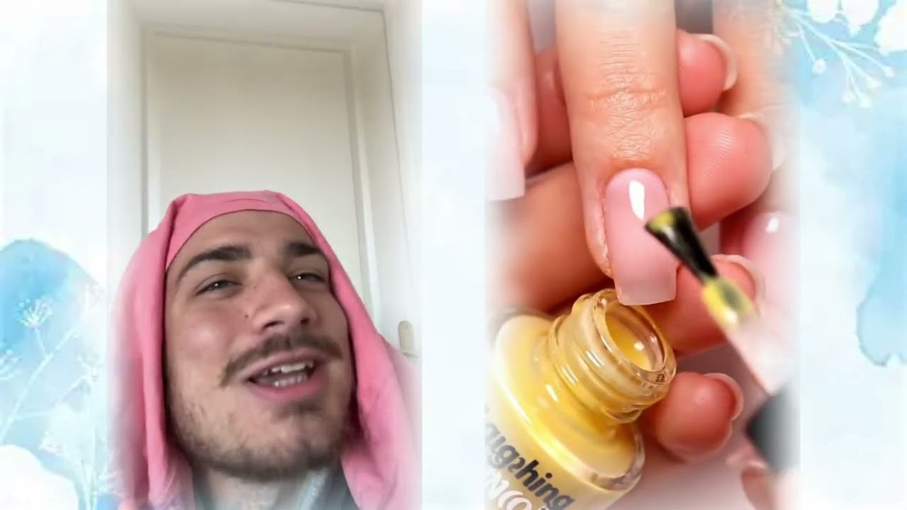 2025Acting Story Collection Starts NOW—Ready to Laugh? 🤣🎭🤣✨