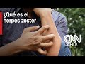 Especialista explica: ¿Qué es el herpes zóster y cuáles son sus consecuencias?