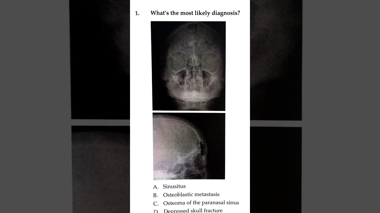 Radiology questions for competitive exams 