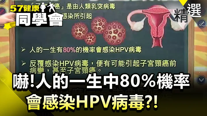 吓！人的一生中80%机率会感染HPV病毒？！【健康同学会】精华篇｜隋安德 许晶晶 - 天天要闻