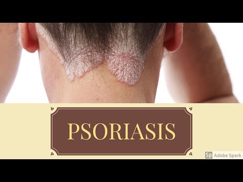 Vídeo: 6 Razones Importantes Para Ver A Su Dermatólogo Para La Psoriasis
