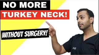 The NONSURGICAL turkey neck lift!