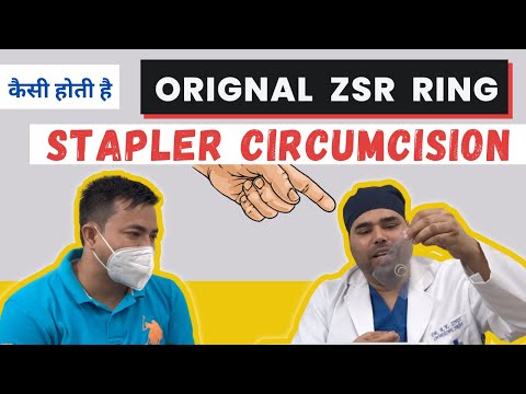 Master the SECRETS of Plastibell Circumcision Care for Your Child: Here's  How! - YouTube