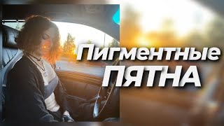ПРО ПИГМЕНТНЫЕ ПЯТНА