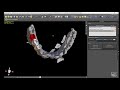 CERIK3D - video 1 - Guía Quirúrgica 3D - BSB by C3D - Blue Sky Plan-