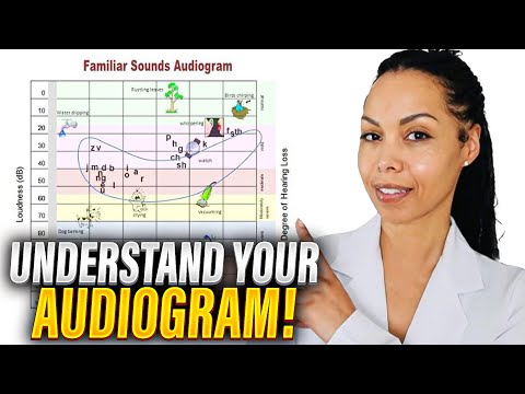 Audiogram Basics: Why These Symbols Matter for Your Hearing