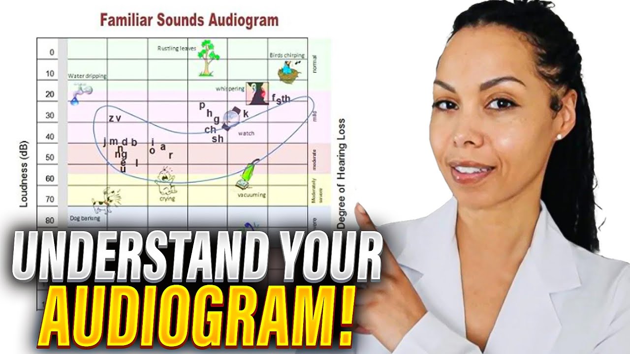 How to Read an Audiogram (Step-by-Step Guide)